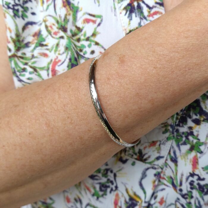 Bracelet Fracture – Image 2